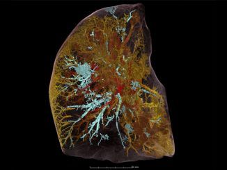 Human Organ Atlas: utilizan los rayos X más brillantes del mundo para crear un mapa de nuestros órganos con una precisión nunca vista